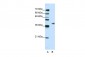 ADAT1 antibody - C-terminal region